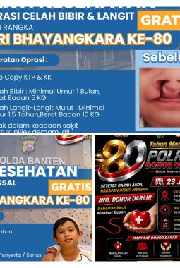 Semarak Hari Bhayangkara ke-80, Polda Banten Gelar Donor Darah dan Khitanan Gratis